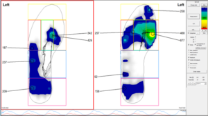 Gebiomized foot pressure analysis used for cycling orthotics Perth assessment at Star Physio