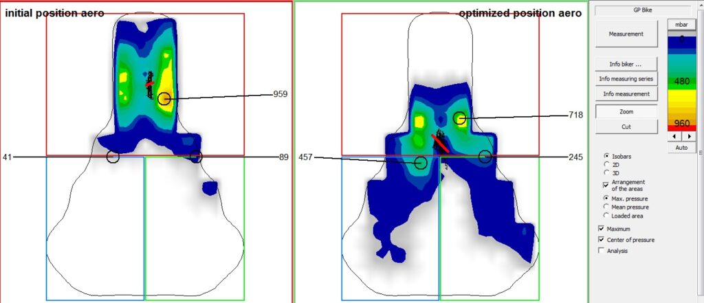 Gebiomized saddle pressure mapping comparison showing painful cycling position before bikefit and improved comfort after professional Bikefit Perth assessment using the same saddle