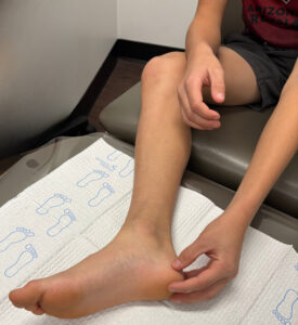 Severs disease heel pain child Perth sports podiatrist Mosman Park